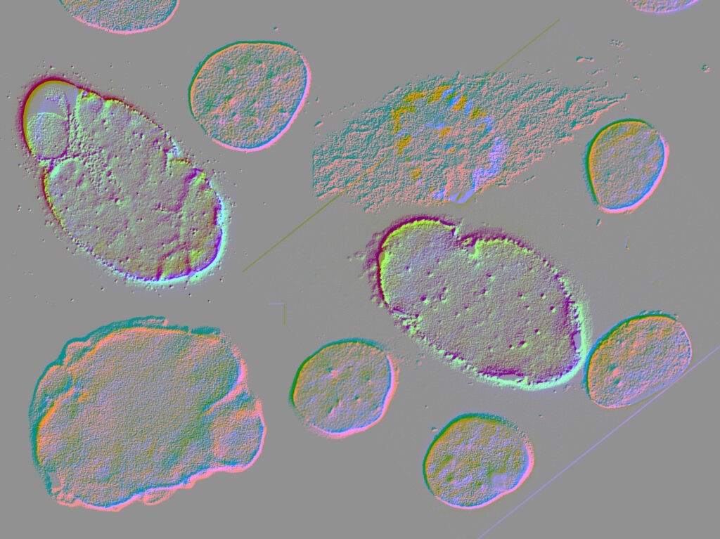 Ricerca-sulle-Laminopatie